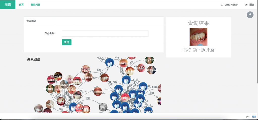 图片[4]-口腔疾病图文多模态知识图谱展示问答系统